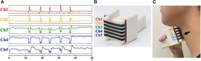 Development and validation of a device for monitoring laryngeal motion during swallowing